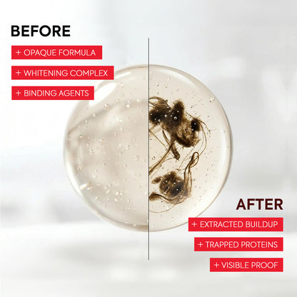 Advanced Stain-LiftingWhitening Mouthwash: VisibleDebris Removal & Fresh Breath-HS