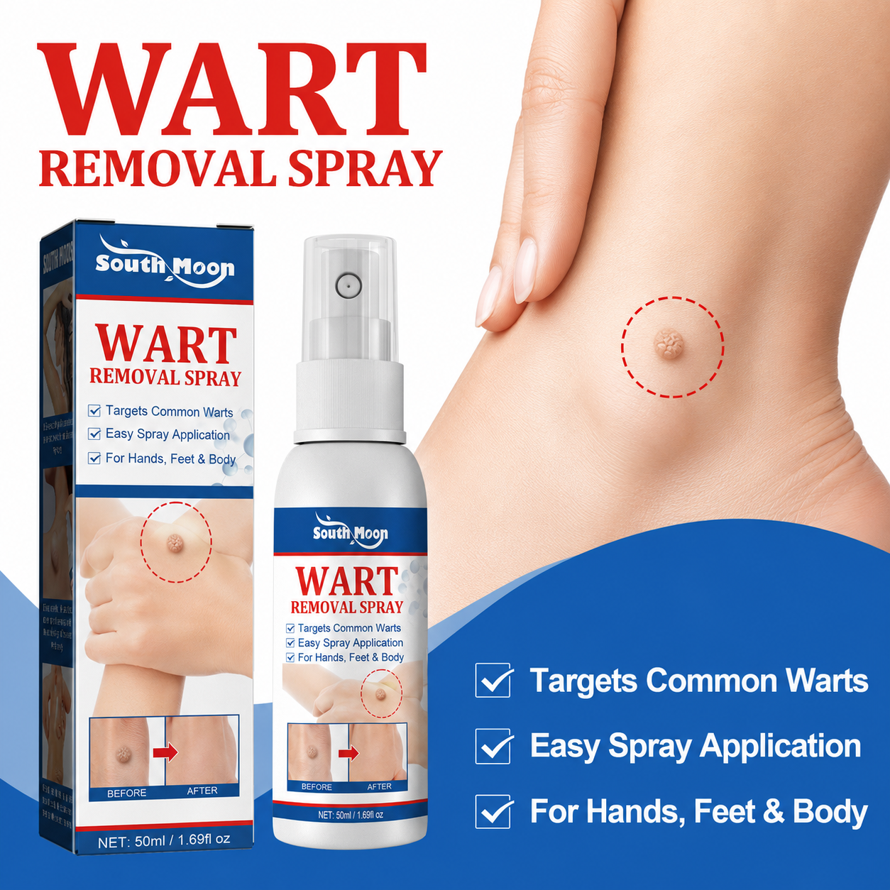 WART REMOVALSPRAY -8WX