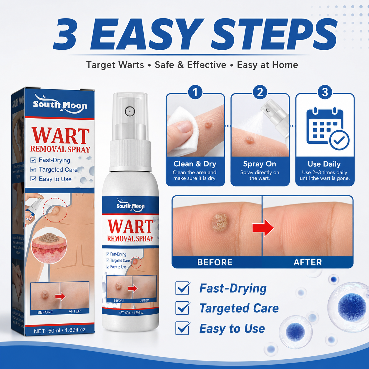 WART REMOVALSPRAY -8WX