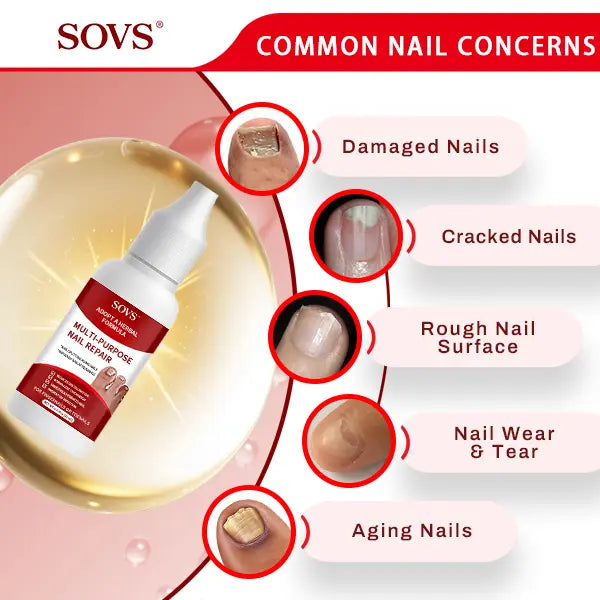 Toenail Fungus Treatment Extra Strength, Antifungal Solution for Toenail or Fingernail, Triple Action Formula for Remove Fungal, Repair and Renewal Damaged Nails-8WX